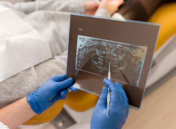 Radiologia Funcional para Fisioterapeutas: Diagnóstico por Imagem na Prática Clínica